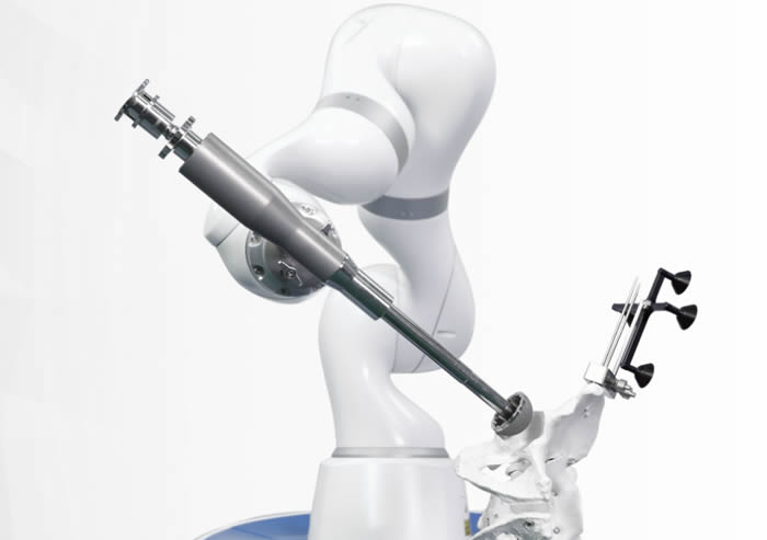 ȫyP(gun)(ji)ÓQg(sh)C(j)ARTHROBOT
